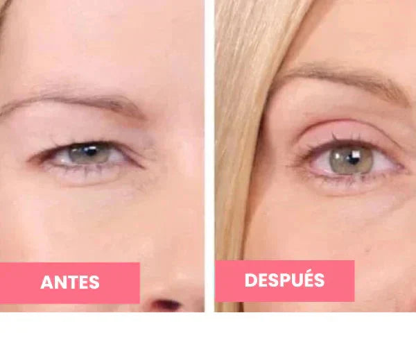 Rejuvenecedor - Palp Lifting Invisible