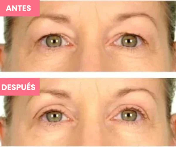 Rejuvenecedor - Palp Lifting Invisible