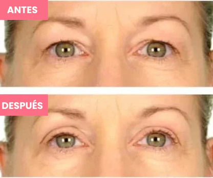 Rejuvenecedor - Palp Lifting Invisible